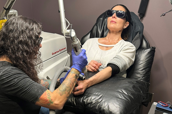 Industry Professionals: Tattoo Removal Costly & Painful